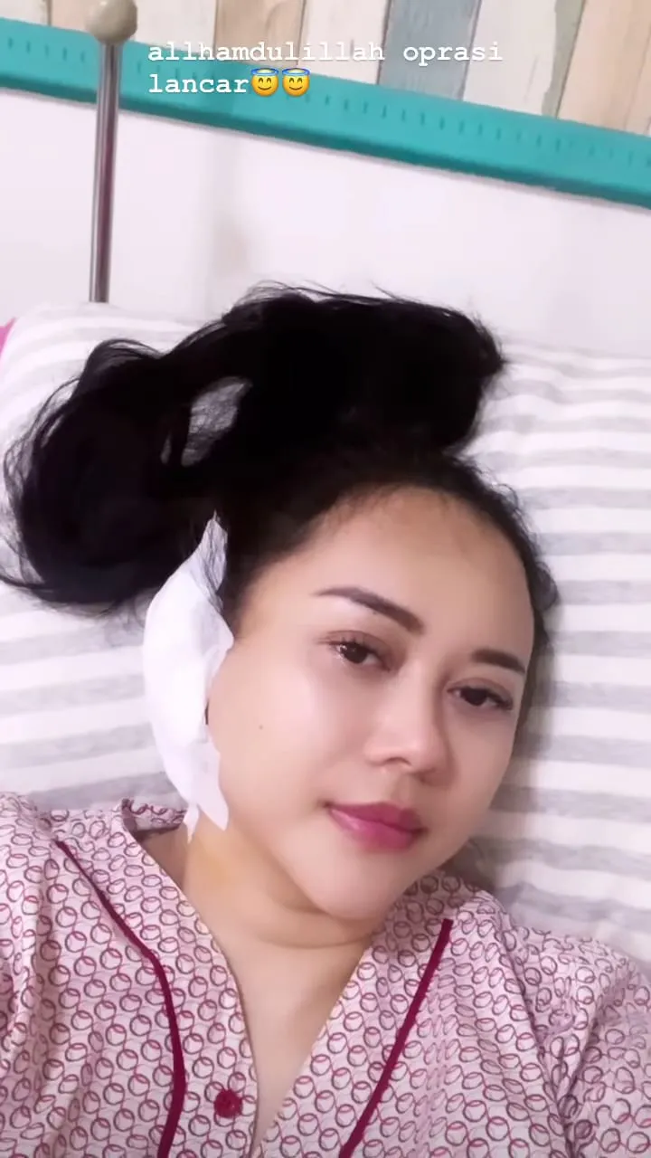 cerita aura kasih operasi © Instagram cerita aura kasih operasi © Instagram