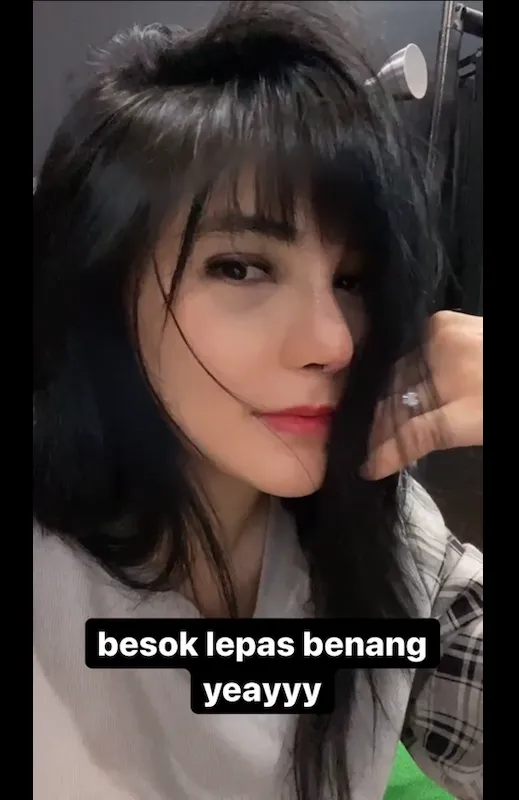 Angela Lee usai operasi hidung Instagram