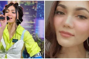15 Penampilan Rina Nose tiru gaya seleb lain, kocak tapi mirip banget