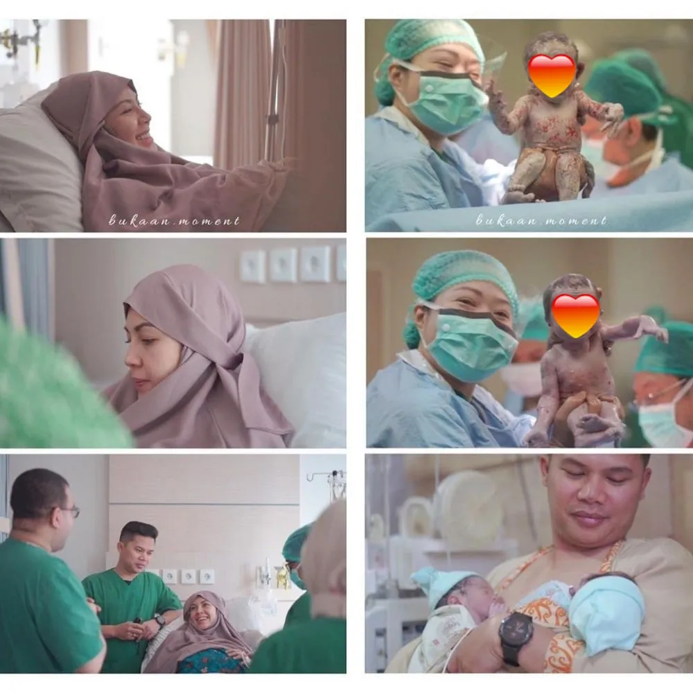 seleb usai melahirkan bayi kembar © 2021 brilio.net