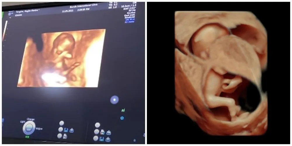 Momen Nagita Slavina cek USG 4D © YouTube Momen Nagita Slavina cek USG 4D © YouTube