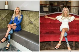 8 Potret Bernadette Hagans, model disabilitas ikuti kontes kecantikan