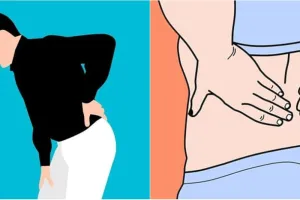 Mengenal saraf terjepit, gejala dan cara penanganannya