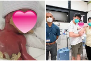Lahir berbobot 212 gram, bayi ini menjadi yang terkecil di dunia