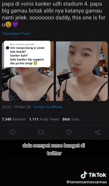 Pria ini ungkap alasan pacarnya milih tampil botak TikTok