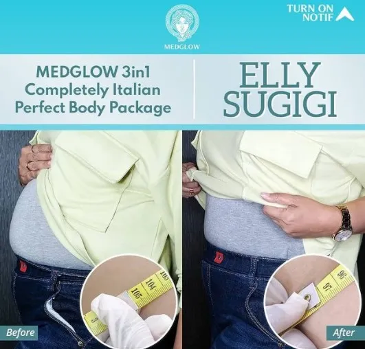 Elly Sugigi sebelum dan sesudah perawatan dari berbagai sumber Elly Sugigi sebelum dan sesudah perawatan dari berbagai sumber