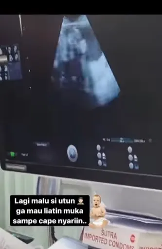 Lesty Kejora jalani USG ditemani Rizky Billar © berbagai sumber Lesty Kejora jalani USG ditemani Rizky Billar © berbagai sumber