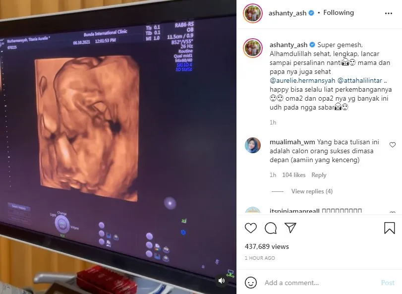 reaksi Ashanty melihat USG Aurel Instagram reaksi Ashanty melihat USG Aurel Instagram