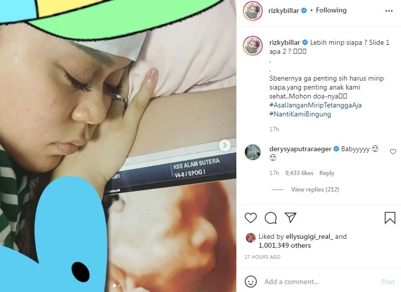 Rizky Billar unggah foto USG © 2021 Instagram Rizky Billar unggah foto USG © 2021 Instagram