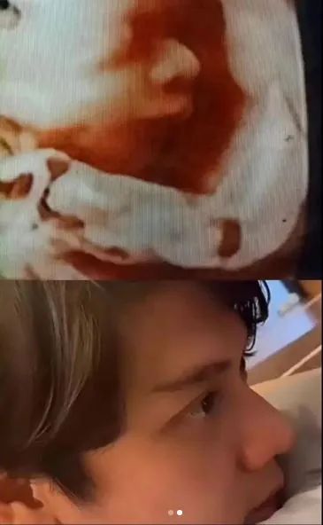 Rizky Billar unggah foto USG © 2021 Instagram Rizky Billar unggah foto USG © 2021 Instagram