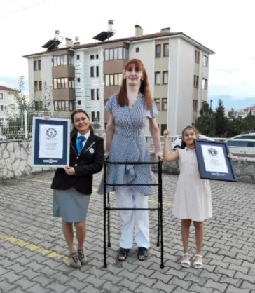 wanita Turki ini tertinggi di dunia © Guinness World Records