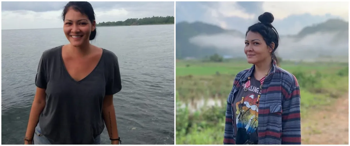 Tumor pecah, Melanie Subono jalani operasi pengangkatan