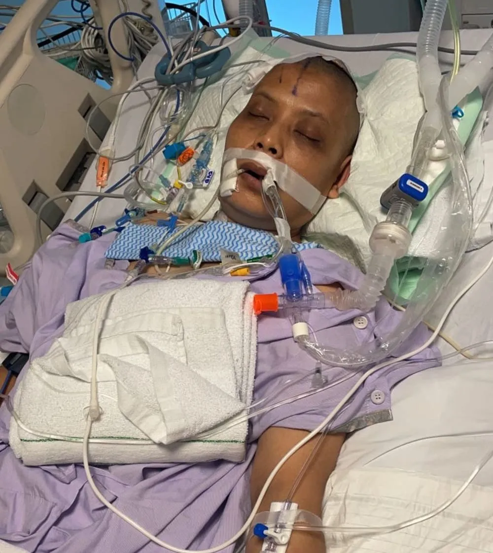 ART Indonesia alami aneurima otak © Facebook ART Indonesia alami aneurima otak © Facebook