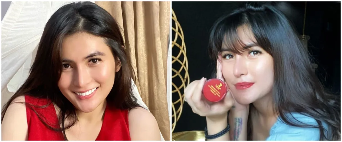 Nyesel operasi hidung sampai implan jebol, begini kondisi Angela Lee