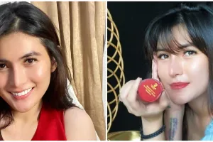 Nyesel operasi hidung sampai implan jebol, begini kondisi Angela Lee