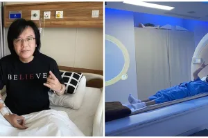 Idap kanker, begini kondisi Ari Lasso usai jalani kemoterapi