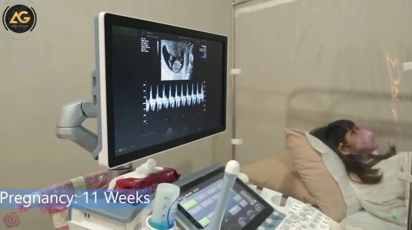 momen Adiezty dan Gilang Dirga cek kandungan © YouTube