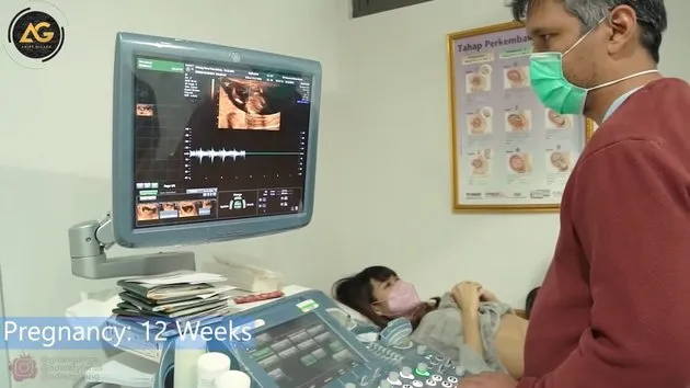 momen Adiezty dan Gilang Dirga cek kandungan © YouTube