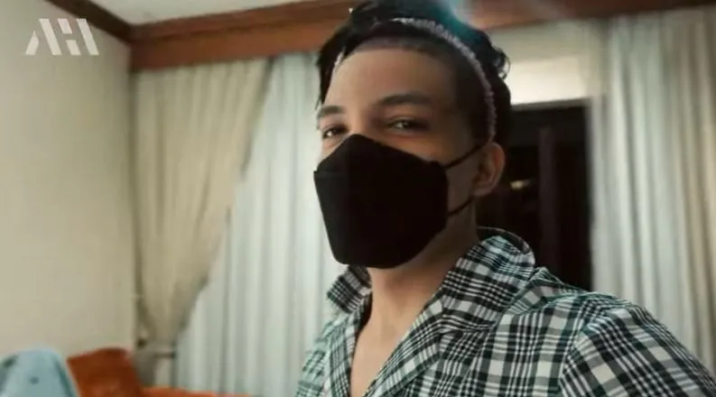 Atta Halilintar usai transplantasi rambut Berbagai sumber