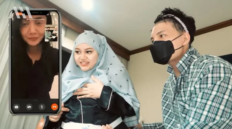 Atta Halilintar usai transplantasi rambut Berbagai sumber