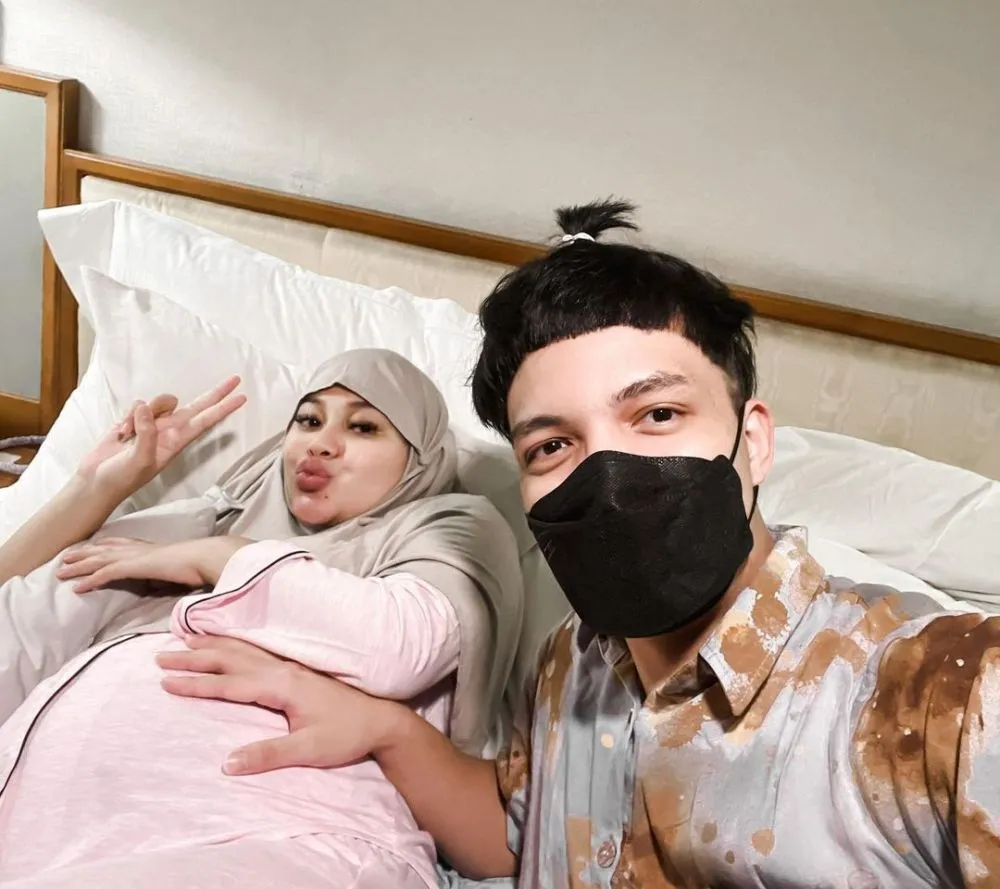 Atta Halilintar usai transplantasi rambut Berbagai sumber