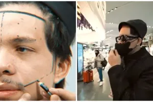 9 Potret Atta Halilintar usai transplantasi rambut, pede tanpa bandana