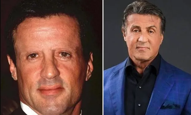 seleb usai transplantasi rambut Berbagai sumber seleb usai transplantasi rambut Berbagai sumber