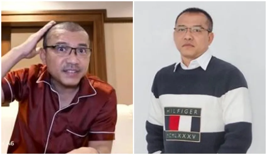 Anang Hermansyah sebelum dan sesudah transplantasi rambut © Instagram Anang Hermansyah sebelum dan sesudah transplantasi rambut © Instagram