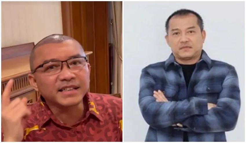 Anang Hermansyah sebelum dan sesudah transplantasi rambut © Instagram Anang Hermansyah sebelum dan sesudah transplantasi rambut © Instagram