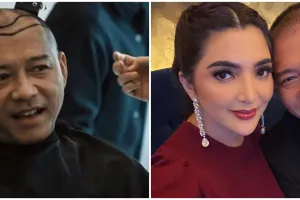 9 Potret Anang Hermansyah sebelum dan sesudah transplantasi rambut