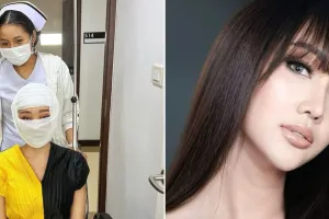 Momen Lucinta Luna operasi wajah, potret terbarunya bikin penasaran