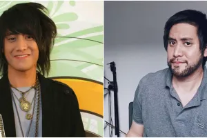 9 Foto dulu vs kini Kevin Aprilio, manglingi usai transplantasi rambut