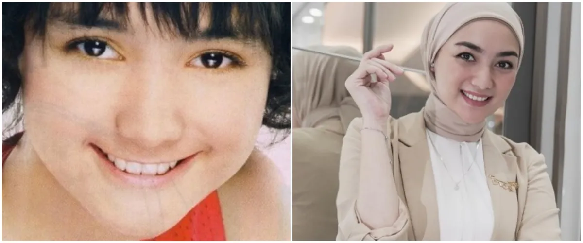 11 Potret awal karier Citra Kirana, imut dengan rambut poni