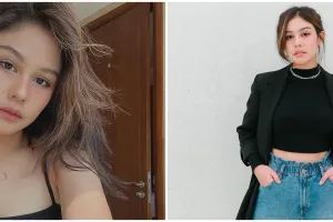 7 Cara atasi hiperpigmentasi ala Vanesha Prescilla, pakai ampoule