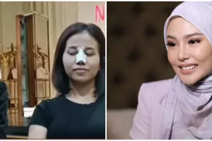 Cerita 11 seleb operasi hidung, terbaru Mayang adik Vanessa Angel