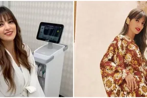 11 Potret rumah megah Nia Ramadhani di Menteng, kolam renangnya mirip di hotel mewah