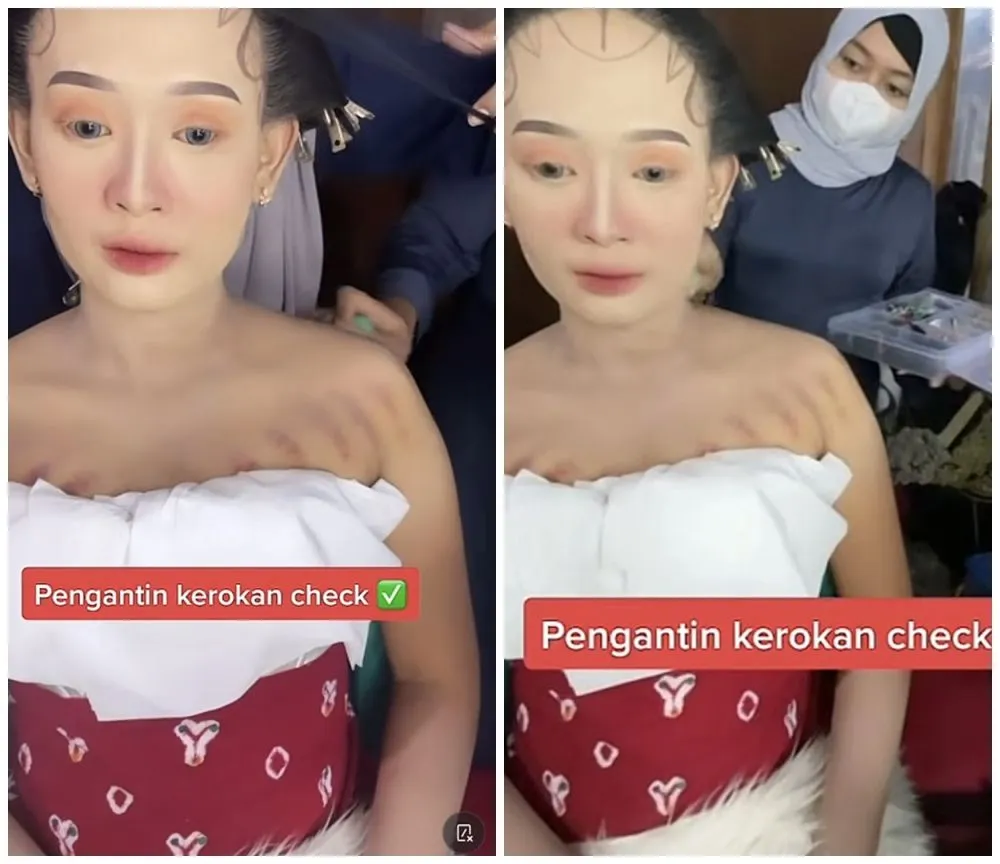 wanita dirias MUA pas ada bekas kerokan © berbagai sumber