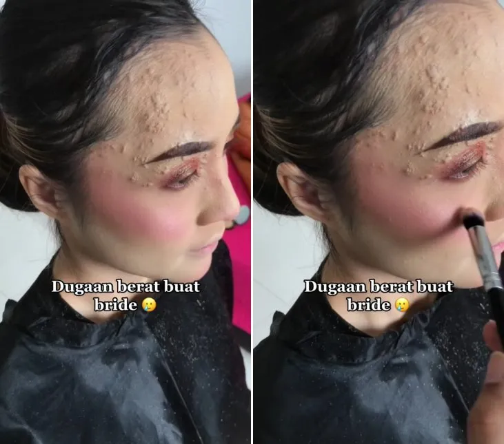 mua rias wajah terinfeksi © TikTok mua rias wajah terinfeksi © TikTok