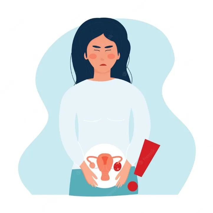 Penyebab kista pada wanita © 2023 brilio.net