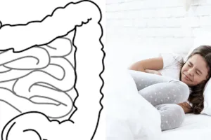 9 Penyebab usus buntu pada anak, kenali gejala dan ketahui cara mencegahnya