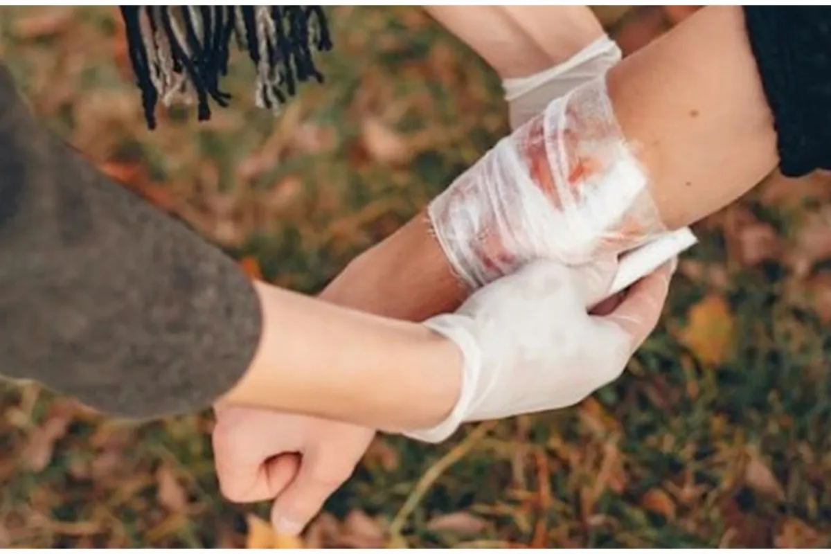 7 Cara mencegah munculnya bekas luka di kulit, gunakan petroleum jelly