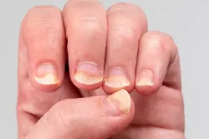 Bukan dengan bawang putih, ini trik kilaukan dan haluskan kuku pakai scrub dari 1 jenis bahan pemanis