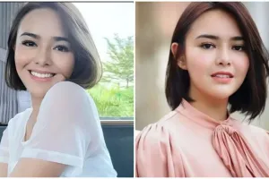 Cerita Amanda Manopo blak-blakan ngaku punya penyakit epilepsi, sering kejang hingga nyaris meninggal