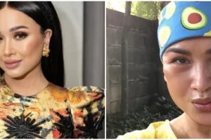 Rogoh kocek sampai Rp 600 juta untuk operasi antiaging, ini 11 potret Titi DJ pede tampil no makeup