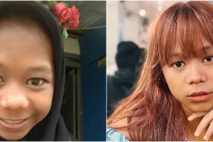 Disebut makin mirip Igun, intip 11 transformasi Cimoy Montok dari dulu hingga kini usai operasi hidung