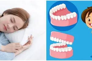 11 Arti mimpi gigi copot semua yang dianggap buruk menurut primbon Jawa, adanya masalah kesehatan