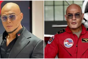 Bukan buat gaya-gayaan, ini alasan Deddy Corbuzier jalani operasi dagu ternyata karena kondisi serius