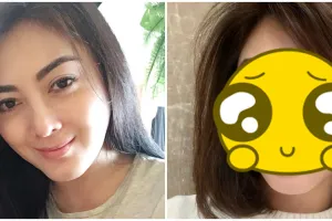 11 Transformasi Dhena Devanka mantan istri Ijonk, merasa 10 tahun lebih muda usai operasi plastik