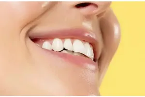 Bukan pakai garam, begini trik memutihkan gigi kuning dan berkerak pakai 1 jenis buah