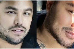 Potret 10 seleb sebelum dan sesudah filler bibir ini penampilannya makin memesona dan seksi